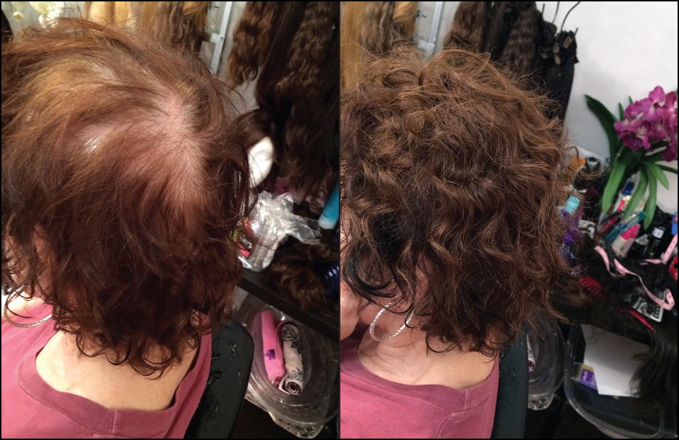 Before and After Gallery of Clients Hair Extensions NYC